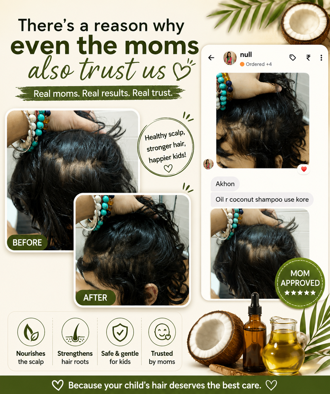 Real moms trust Royally Homemade — before and after results for kids' hair